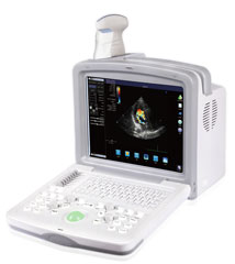 купить портативный узи аппарат S-800-5